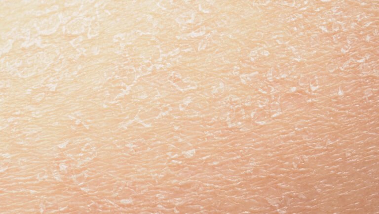 gros plan d'une peau seche