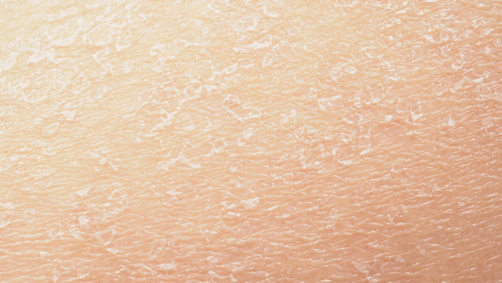 gros plan d'une peau seche